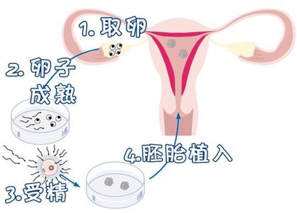 暖阳生殖医学中心
